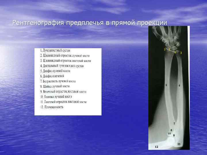 Рентгенография предплечья в прямой проекции 