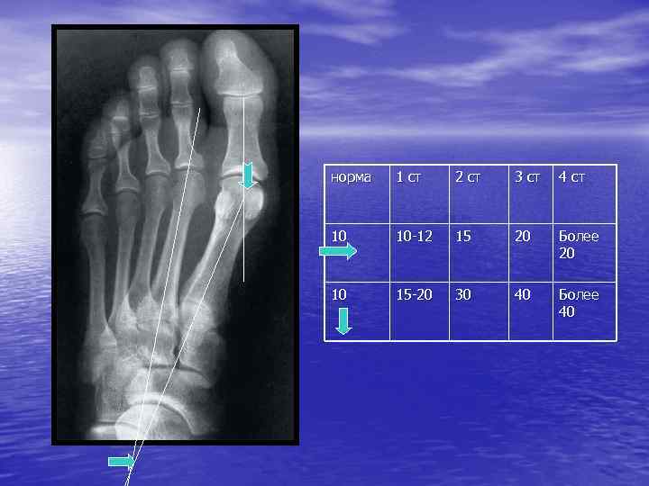 норма 1 ст 2 ст 3 ст 4 ст 10 10 -12 15 20