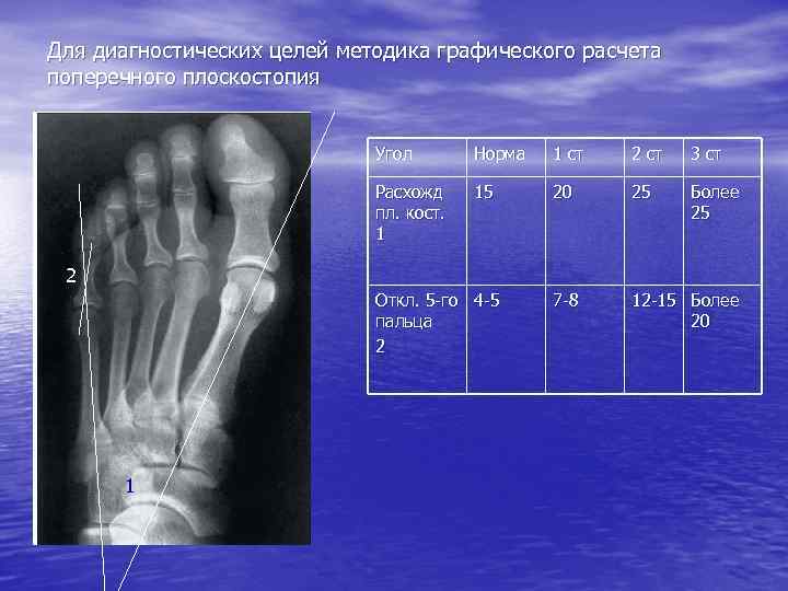 Схема описания рентгенограммы костей