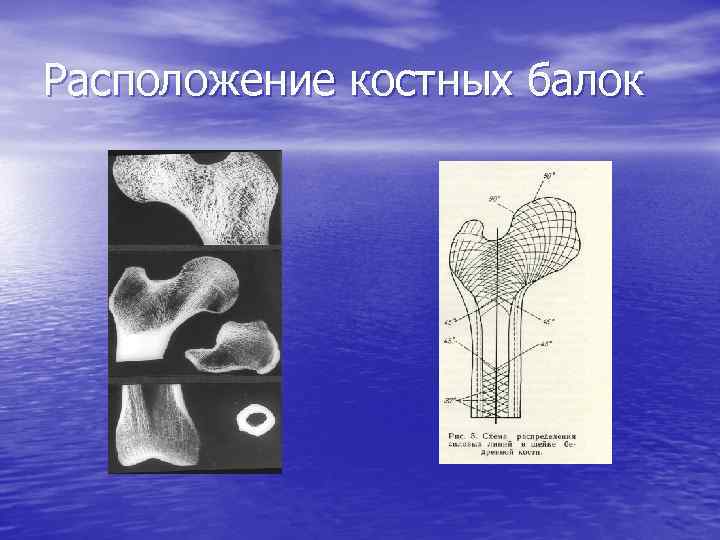 Расположение костных балок 