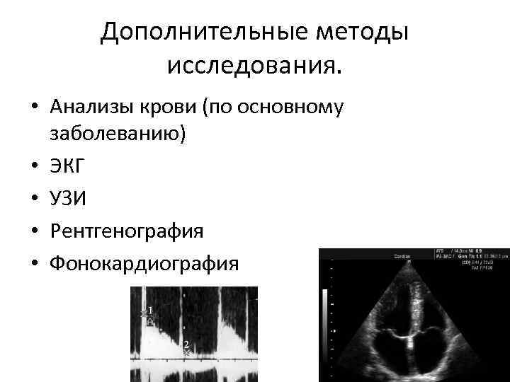 Дополнительные методы исследования. • Анализы крови (по основному заболеванию) • ЭКГ • УЗИ •
