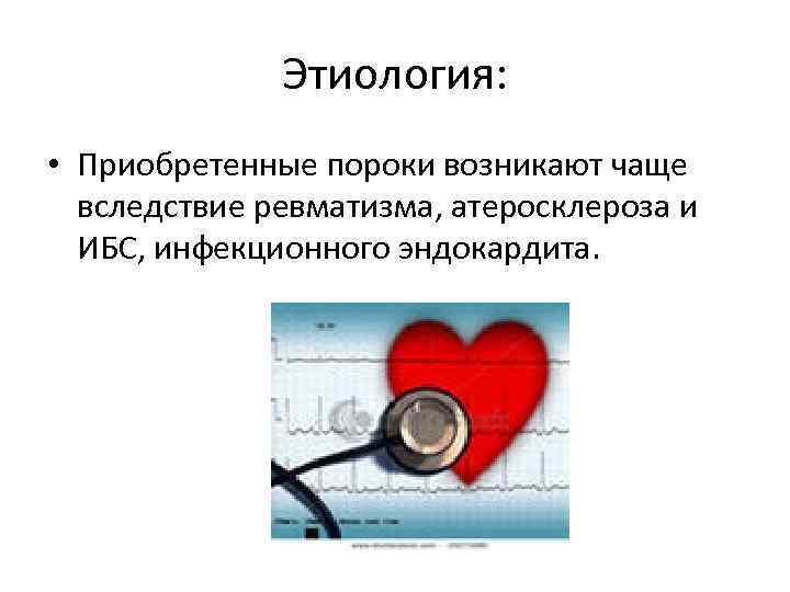 Этиология: • Приобретенные пороки возникают чаще вследствие ревматизма, атеросклероза и ИБС, инфекционного эндокардита. 