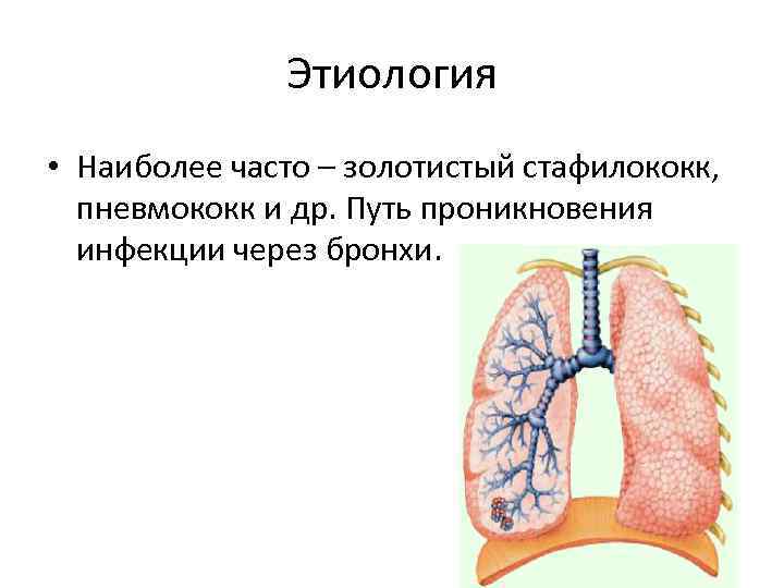 Этиология • Наиболее часто – золотистый стафилококк, пневмококк и др. Путь проникновения инфекции через
