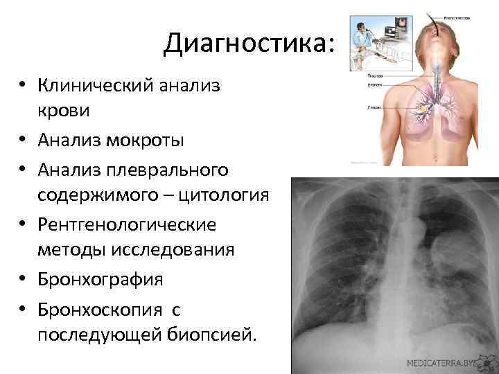 Анализы показывающие рак легких