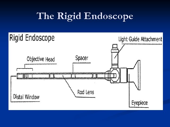 The Rigid Endoscope 