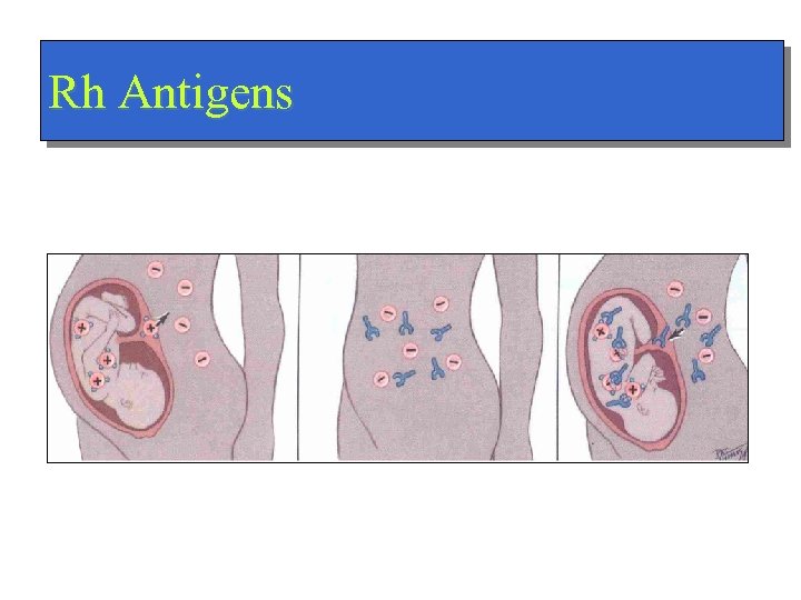 Rh Antigens 