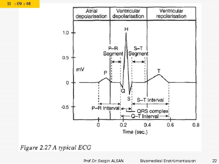 Prof. Dr. Sezgin ALSAN Biyomedikal Enstrümantasyon 22 