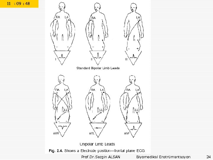 Prof. Dr. Sezgin ALSAN Biyomedikal Enstrümantasyon 24 