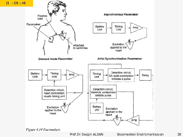 Prof. Dr. Sezgin ALSAN Biyomedikal Enstrümantasyon 28 