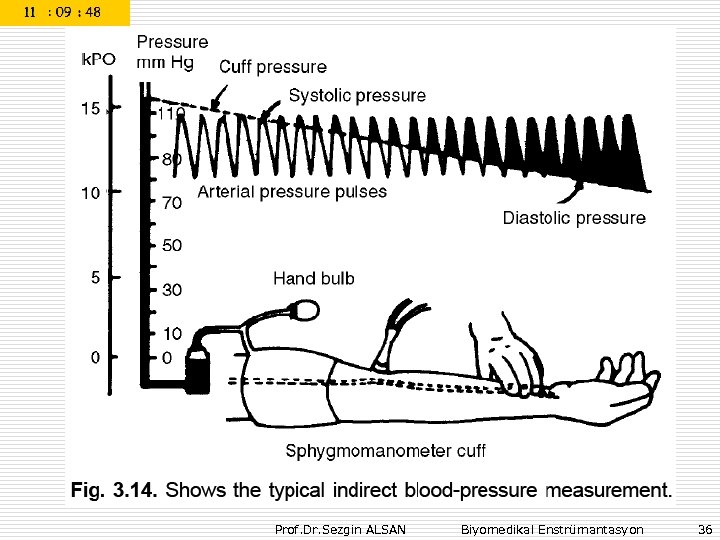 Prof. Dr. Sezgin ALSAN Biyomedikal Enstrümantasyon 36 