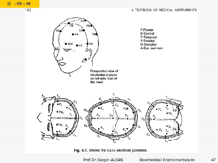 Prof. Dr. Sezgin ALSAN Biyomedikal Enstrümantasyon 47 