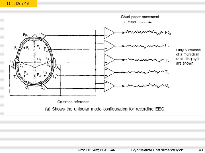 Prof. Dr. Sezgin ALSAN Biyomedikal Enstrümantasyon 48 