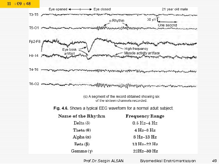 Prof. Dr. Sezgin ALSAN Biyomedikal Enstrümantasyon 49 