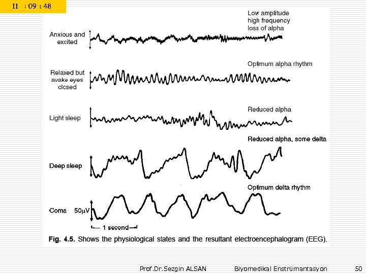 Prof. Dr. Sezgin ALSAN Biyomedikal Enstrümantasyon 50 