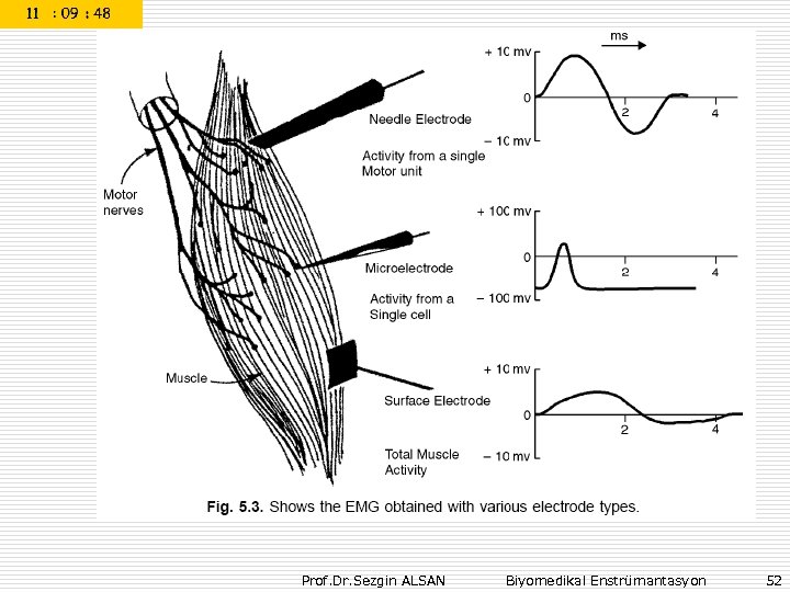 Prof. Dr. Sezgin ALSAN Biyomedikal Enstrümantasyon 52 