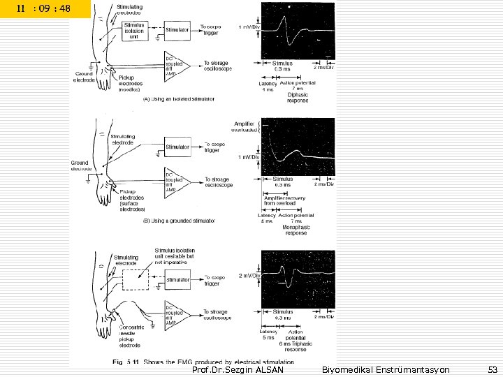 Prof. Dr. Sezgin ALSAN Biyomedikal Enstrümantasyon 53 