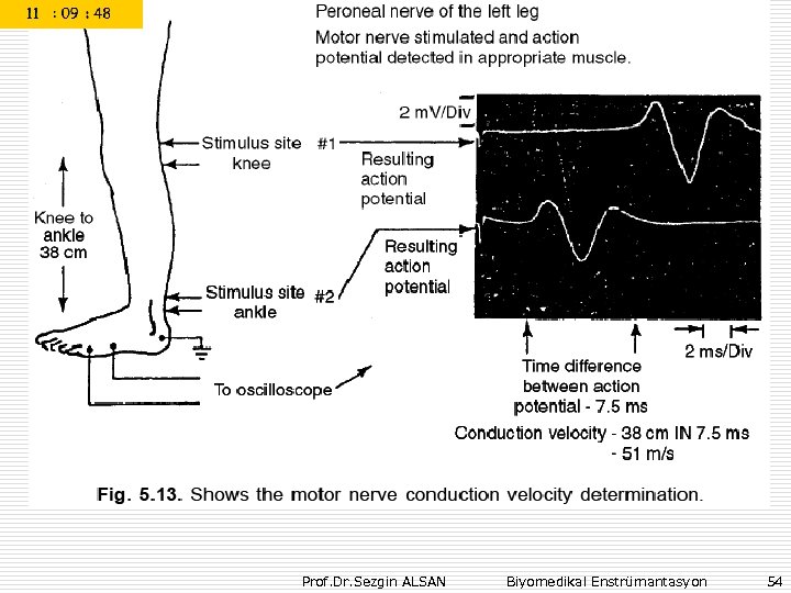 Prof. Dr. Sezgin ALSAN Biyomedikal Enstrümantasyon 54 