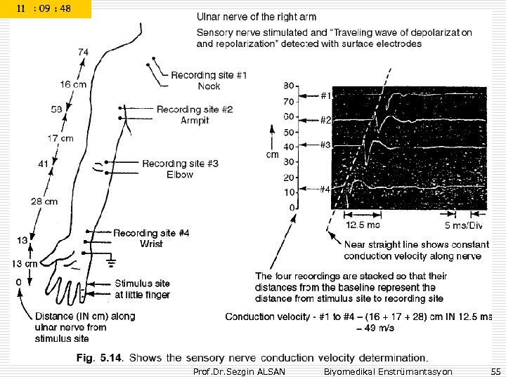 Prof. Dr. Sezgin ALSAN Biyomedikal Enstrümantasyon 55 