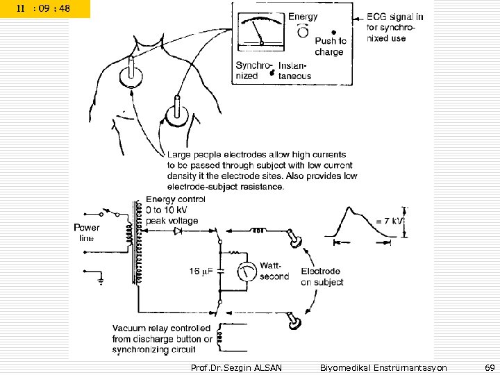 Prof. Dr. Sezgin ALSAN Biyomedikal Enstrümantasyon 69 
