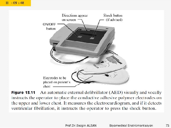 Prof. Dr. Sezgin ALSAN Biyomedikal Enstrümantasyon 73 