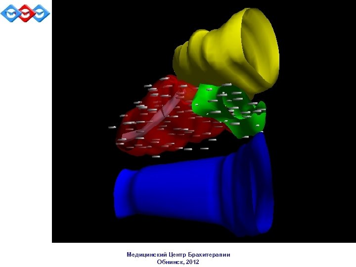 Медицинский Центр Брахитерапии Обнинск, 2012 
