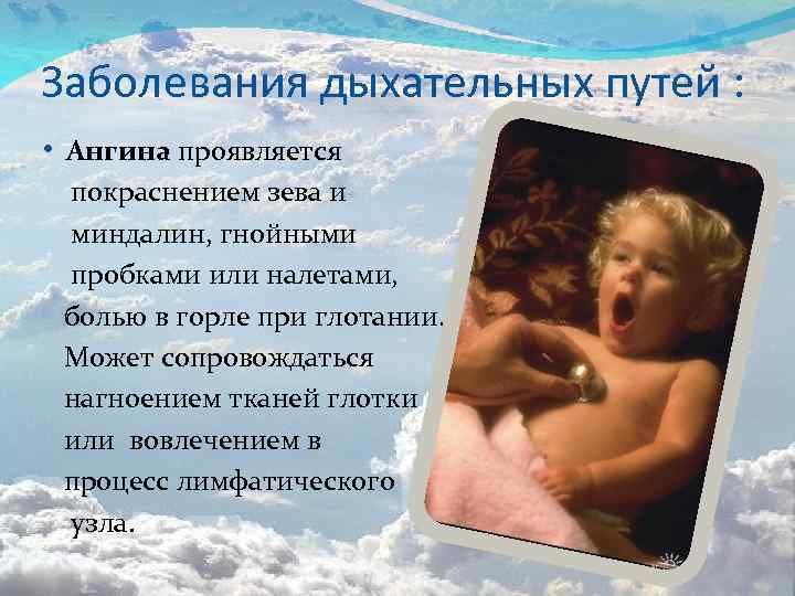 Заболевания дыхательных путей : • Ангина проявляется покраснением зева и миндалин, гнойными пробками или