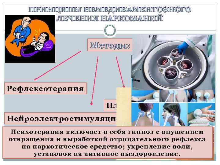 ПРИНЦИПЫ НЕМЕДИКАМЕНТОЗНОГО ЛЕЧЕНИЯ НАРКОМАНИЙ Методы: Различные методы психотерапии Рефлексотерапия Плазмаферез Нейроэлектростимуляция Психотерапия включает в