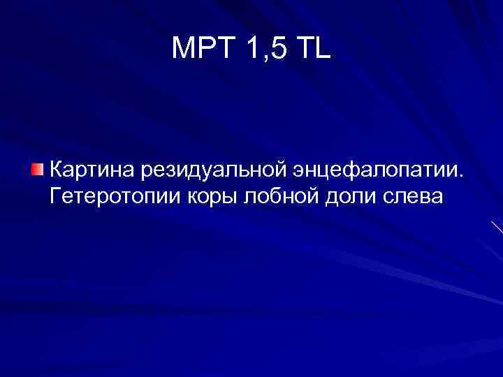 МРТ 1, 5 TL Картина резидуальной энцефалопатии. Гетеротопии коры лобной доли слева 