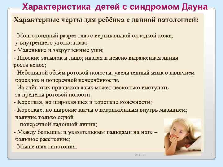 Характеристика детей с синдромом Дауна Характерные черты для ребёнка с данной патологией: - Монголоидный
