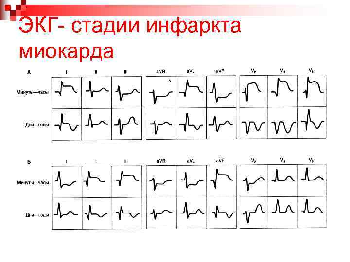 Карта вызова инфаркт миокарда