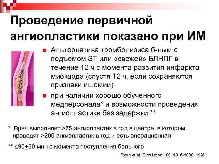 Проведение первичной ангиопластики показано при ИМ n n Альтернатива тромболизиса б-ным с подъемом ST