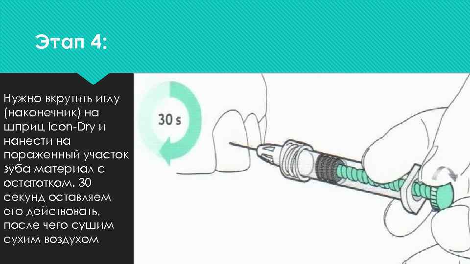 Этап 4: Нужно вкрутить иглу (наконечник) на шприц Icon-Dry и нанести на пораженный участок