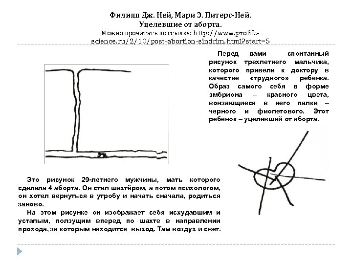 Филипп Дж. Ней, Мари Э. Питерс-Ней. Уцелевшие от аборта. Можно прочитать по ссылке: http: