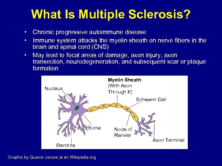 What Is Multiple Sclerosis? • Chronic progressive autoimmune disease • Immune system attacks the