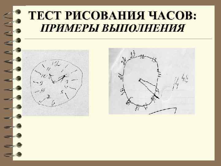 ТЕСТ РИСОВАНИЯ ЧАСОВ: ПРИМЕРЫ ВЫПОЛНЕНИЯ 