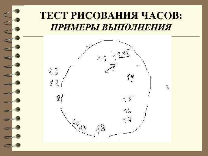 Как определить деменцию. Интерпретация теста рисования часов. Оценка теста рисования часов. Тест на деменцию рисование часов. Тест часы для деменции.