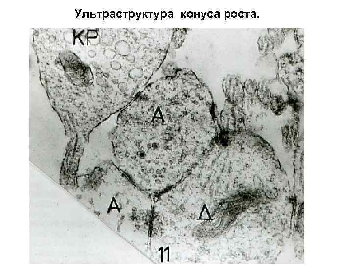 Ультраструктура конуса роста. 