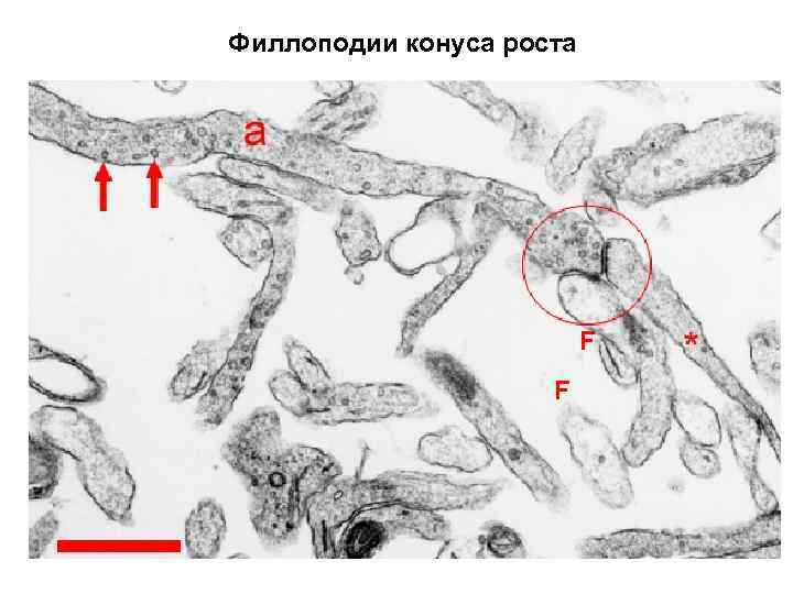 Филлоподии конуса роста F F 