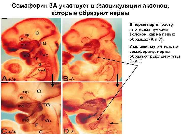 Семафорин 3 А участвует в фасцикуляции аксонов, которые образуют нервы В норме нервы растут