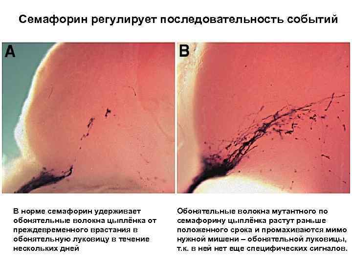Семафорин регулирует последовательность событий В норме семафорин удерживает обонятельные волокна цыплёнка от преждевременного врастания