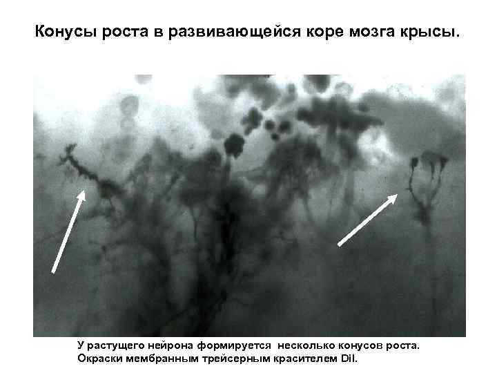 Конусы роста в развивающейся коре мозга крысы. У растущего нейрона формируется несколько конусов роста.