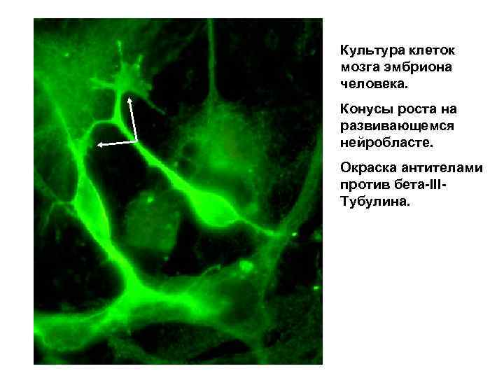 Культура клеток мозга эмбриона человека. Конусы роста на развивающемся нейробласте. Окраска антителами против бета-IIIТубулина.