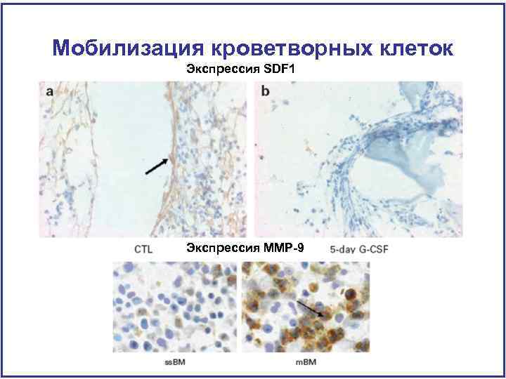 Мобилизация кроветворных клеток Экспрессия SDF 1 Экспрессия MMP-9 