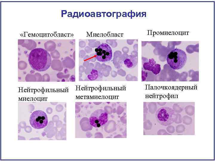 Радиоавтография «Гемоцитобласт» Миелобласт Нейтрофильный метамиелоцит Промиелоцит Палочкоядерный нейтрофил 