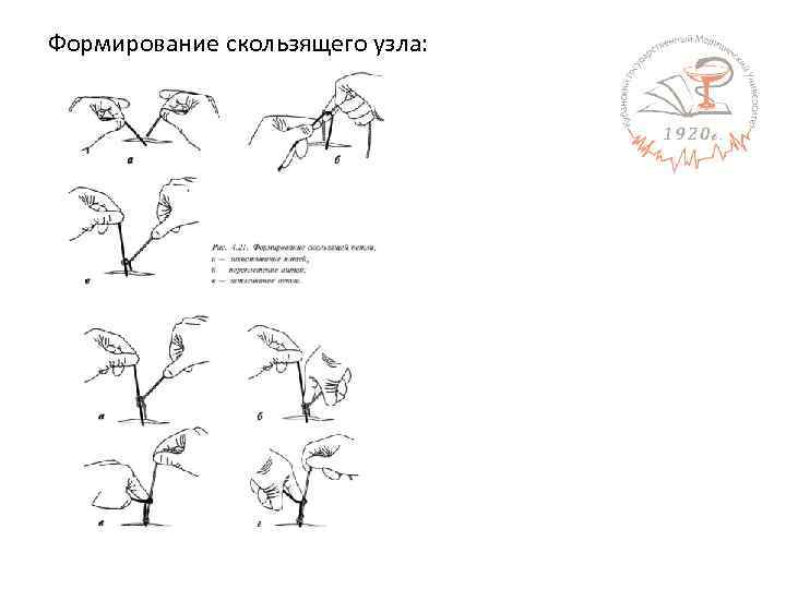 Формирование скользящего узла: 