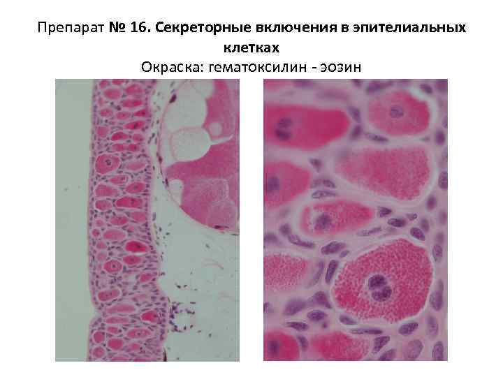 Задняя стенка глазного яблока окраска гематоксилином и эозином большое увеличение