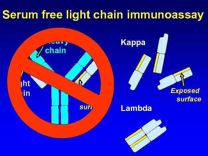 Serum free light chain immunoassay Heavy chain Light chain Kappa Hidden surface Exposed surface