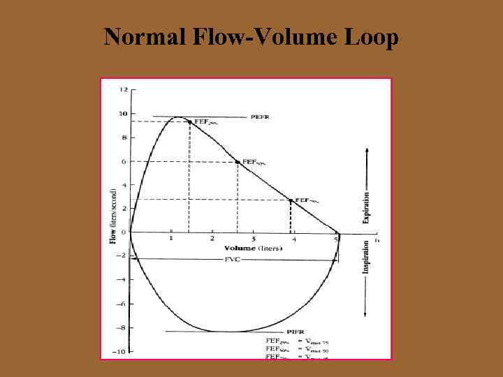 Normal Flow-Volume Loop 