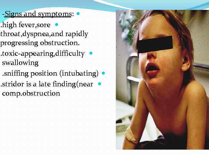 -Signs and symptoms: . high fever, sore throat, dyspnea, and rapidly progressing obstruction. .