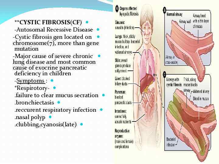 **CYSTIC FIBROSIS(CF) -Autosomal Recessive Disease -Cystic fibrosis gen located on chromosome(7), more than gene